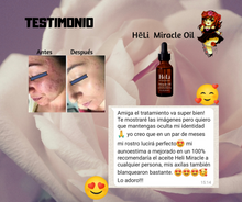 Cargar imagen en el visor de la galería, Heli - Miracle Oil